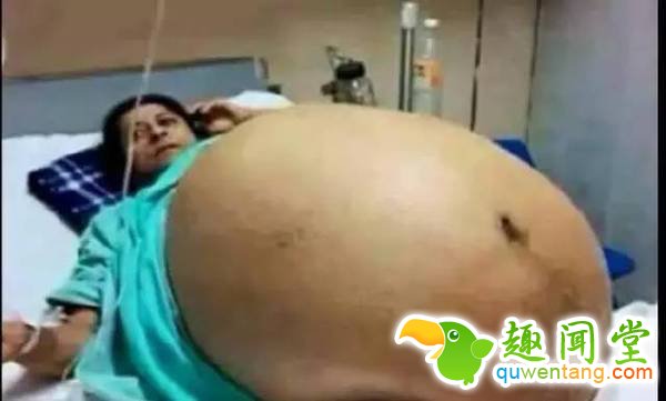 一胎生了11个娃