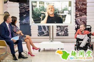 人类换头术能否成功？这