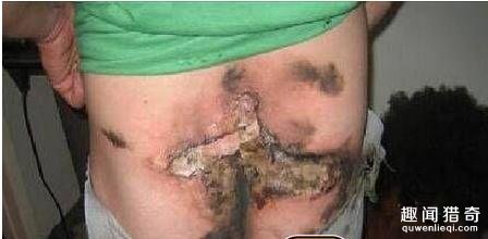 天天放屁，你却不知道的10个“屁知识”！