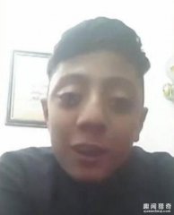 吓呆！14岁少年能将眼球弹出10毫米