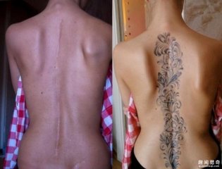 纹身拯救伤疤，甚至还能还你一只“眼睛”