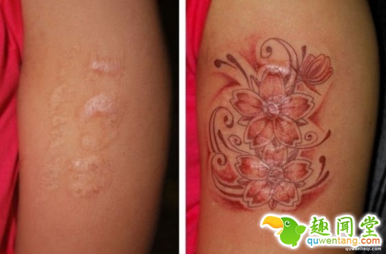 纹身拯救伤疤，甚至还能还你一只“眼睛”！