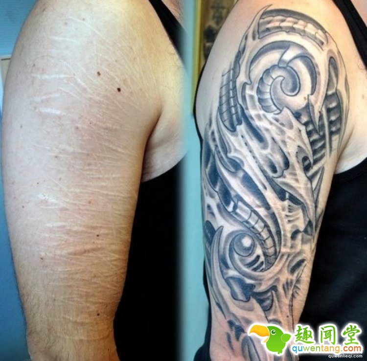 纹身拯救伤疤，甚至还能还你一只“眼睛”！