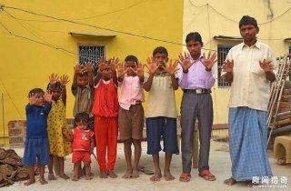 印度一特殊的家族：孩子天生有12根手指