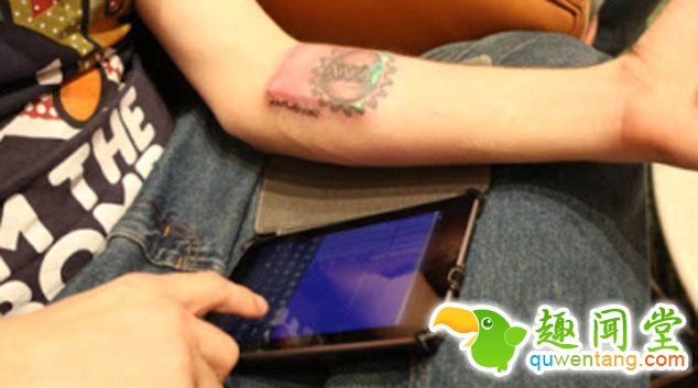 　　这项15分钟的手术由美国匹兹堡一家公司提供，他们声称所使用的技术安全无害。研发这项技术的人员表示：“一些人联系我们，因为他们想要点亮他们的纹身。所以我们开发了这项移植技术?！闭庵肿爸靡怨栉饪?，3伏的电池为它供电，一共可以点亮1万次。