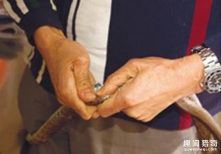 恐怖！他连吞3个蛇胆补身体　寄生虫进脑