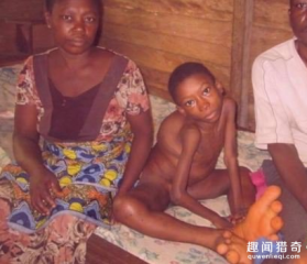 10岁男孩双脚不停地生长，村民把他当成妖