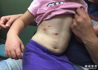 4岁女童遭狮子袭击: 母亲奋力施救 结果…