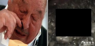 超恶心！老大爷鼻子流鼻血不止还飞出虫子