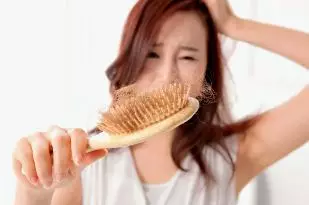 医生证明90后真秃了:这代人比他们父辈脱发来得早